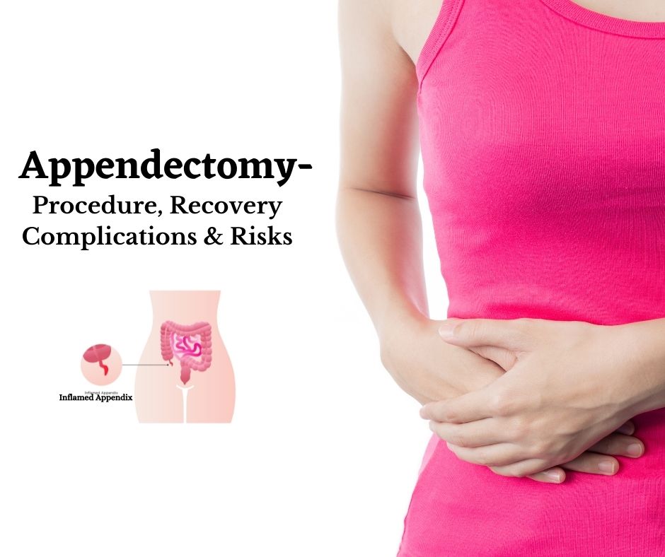 Appendectomy treatment in pune