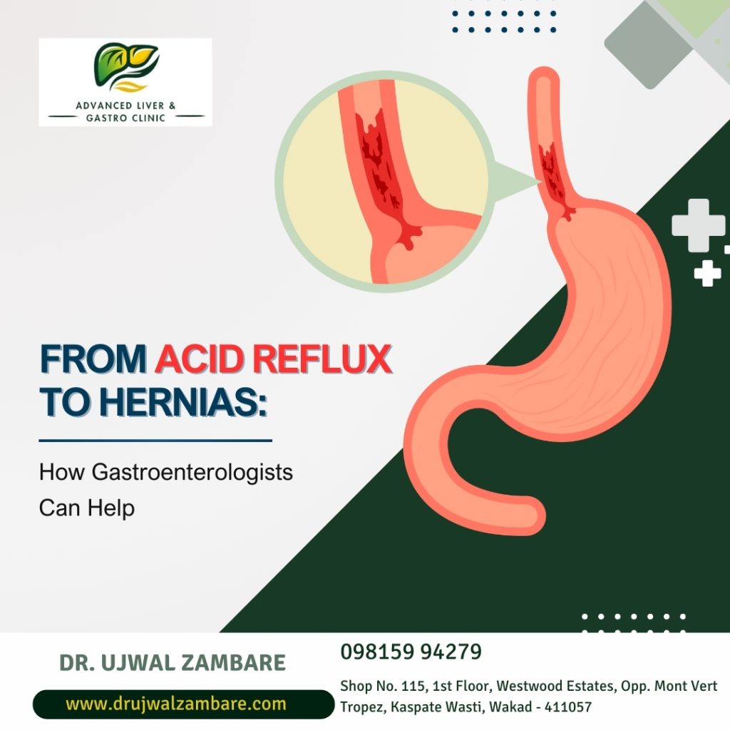 DR Ujwal Zambare Gastroenterologist in Wakad