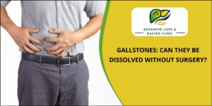 Gallstone surgery