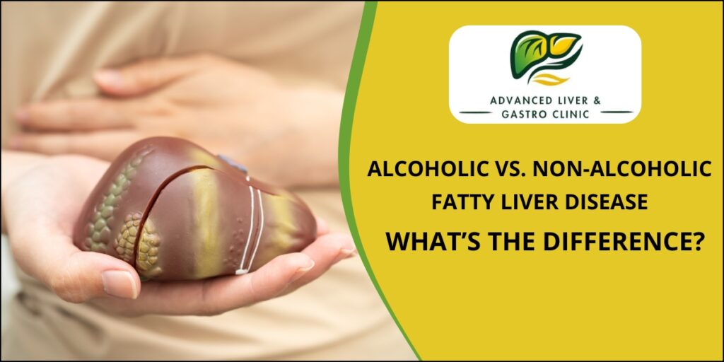 Alcoholic vs Non Alcoholic Liver Disease