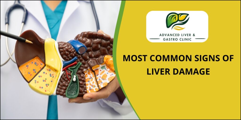 Signs of liver damage