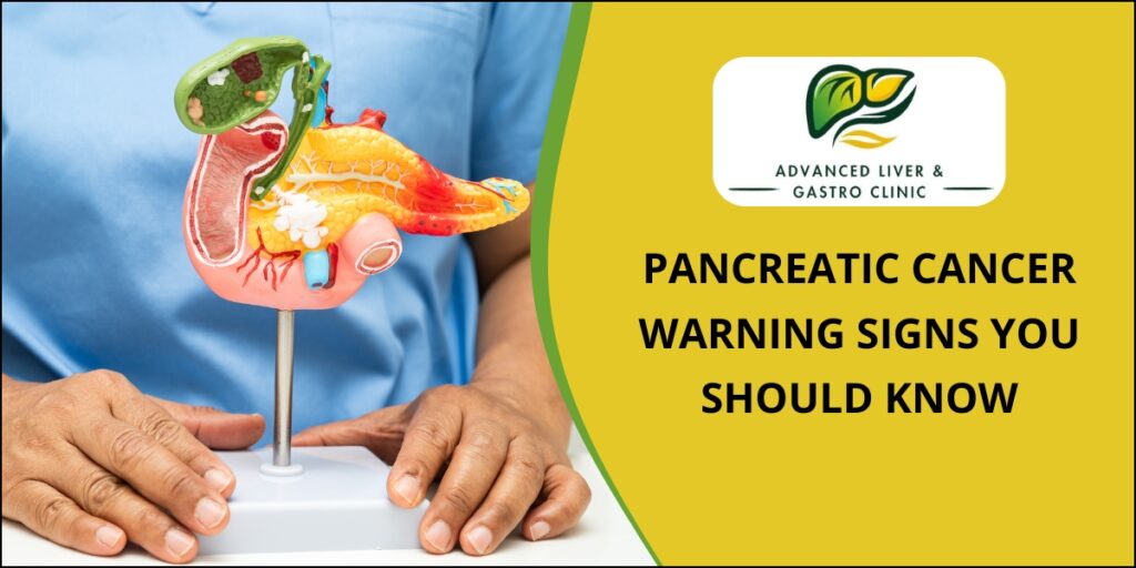 Pancreatic Cancer Treatment