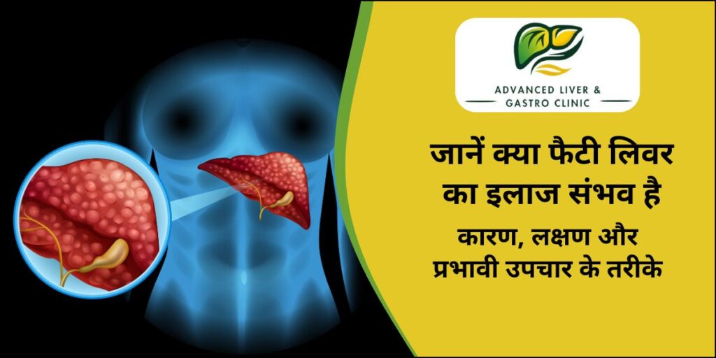 Is fatty liver curable?