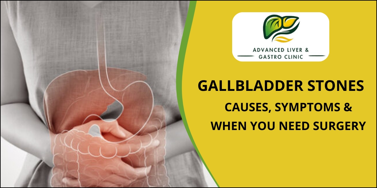 Gallbladder Stones - Symptoms and Causes