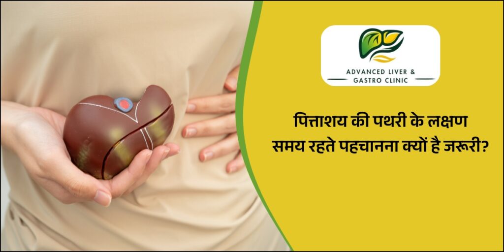 पित्ताशय की पथरी के लक्षण