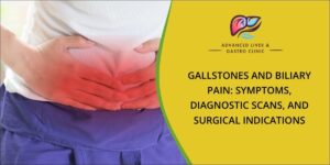 Gallstone and biliary pain symptoms